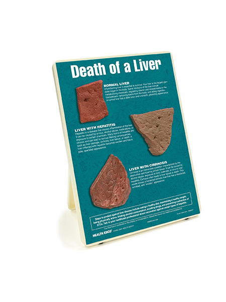 Death of a Liver Easel Display