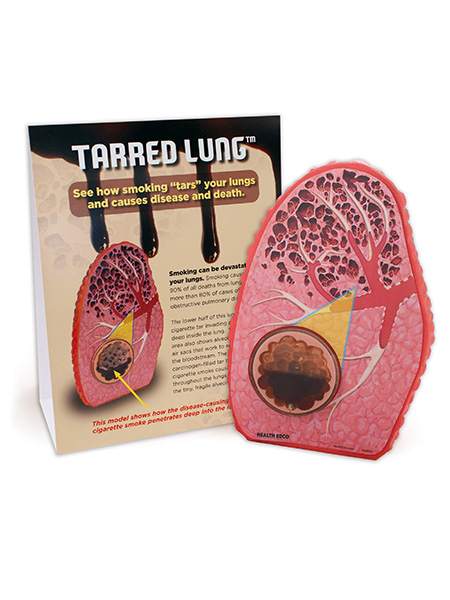 Tarred Lung Model